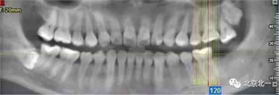 360截圖20170123204119166.jpg 360截圖20170123204119166.jpg