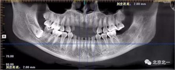 360截圖20170123204132532.jpg 360截圖20170123204132532.jpg