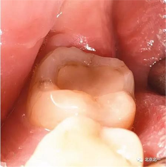 360截圖20170123204210580.jpg 360截圖20170123204210580.jpg