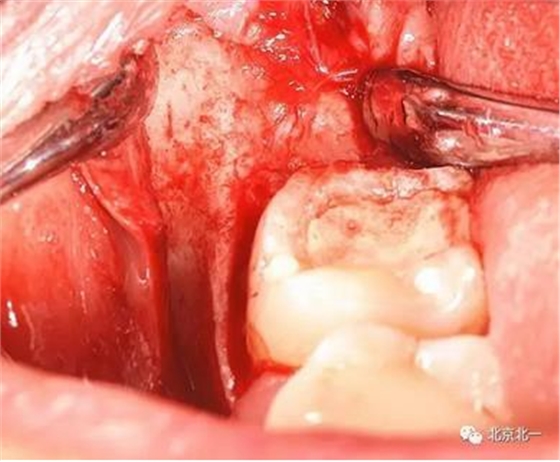 360截圖20170123204218931.jpg 360截圖20170123204218931.jpg