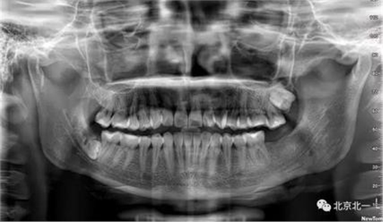 360截圖20170123204228380.jpg 360截圖20170123204228380.jpg