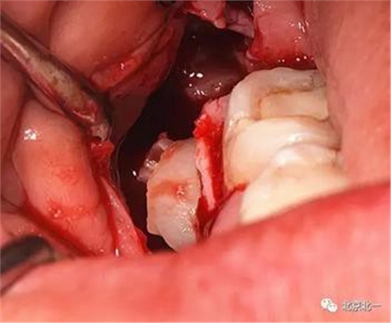 360截圖20170123204307731.jpg 360截圖20170123204307731.jpg