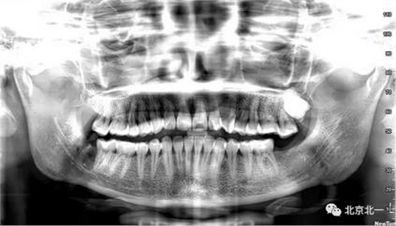 360截圖20170123204326819.jpg 360截圖20170123204326819.jpg