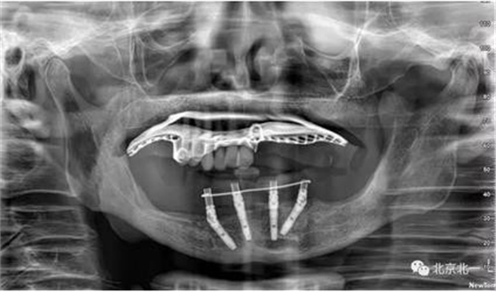 360截圖20170124110357783.jpg 360截圖20170124110357783.jpg