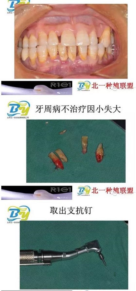 360截圖20170124112724720.jpg 360截圖20170124112724720.jpg