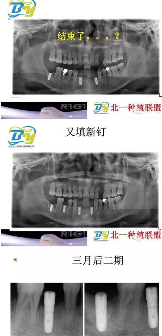 360截圖20170124112802856.jpg 360截圖20170124112802856.jpg