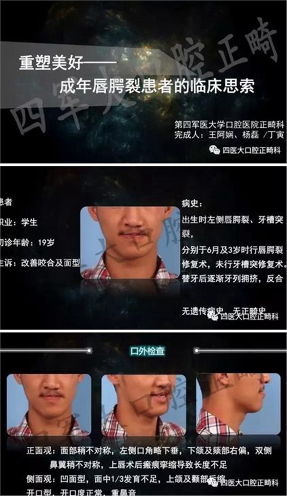 360截圖20170124164019279.jpg 360截圖20170124164019279.jpg