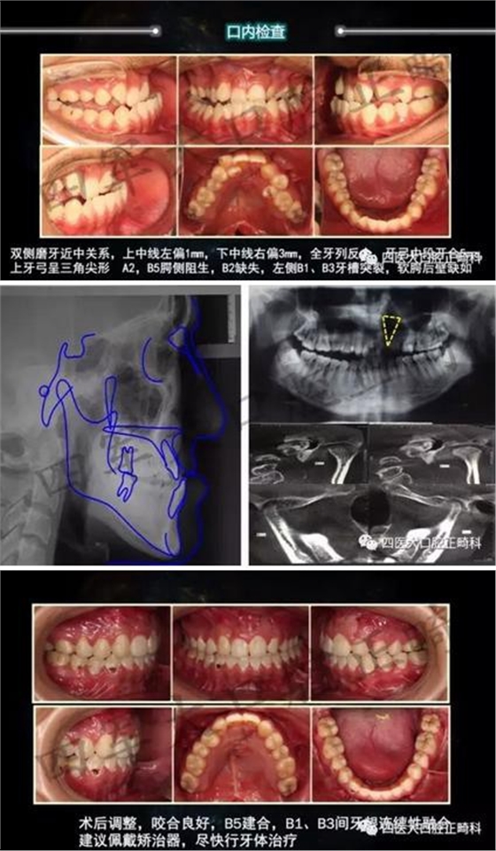 360截圖20170124164042448.jpg 360截圖20170124164042448.jpg