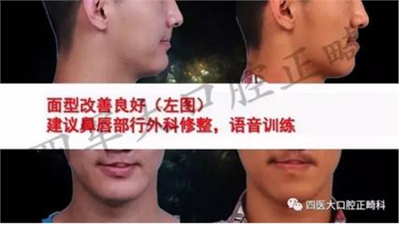 360截圖20170124164054470.jpg 360截圖20170124164054470.jpg