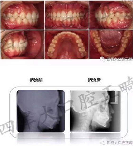 360截圖20170124164144135.jpg 360截圖20170124164144135.jpg