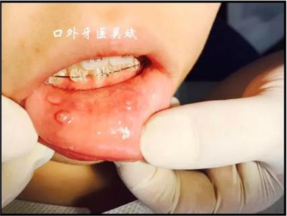 360截圖20170124184514557.jpg 360截圖20170124184514557.jpg