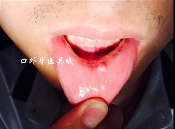 360截圖20170124184522725.jpg 360截圖20170124184522725.jpg