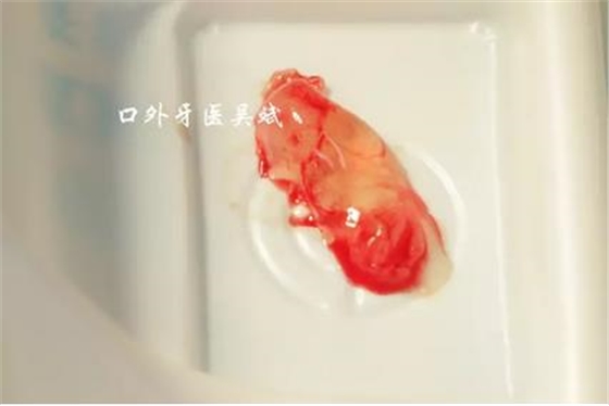 360截圖20170124184531893.jpg 360截圖20170124184531893.jpg