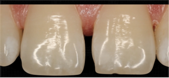 圖片11.png 圖片11.png