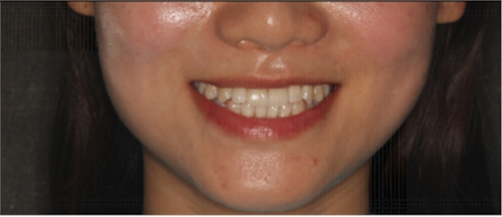 圖片28.png 圖片28.png