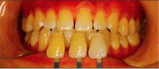 圖片22.png 圖片22.png