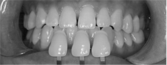 圖片21.png 圖片21.png