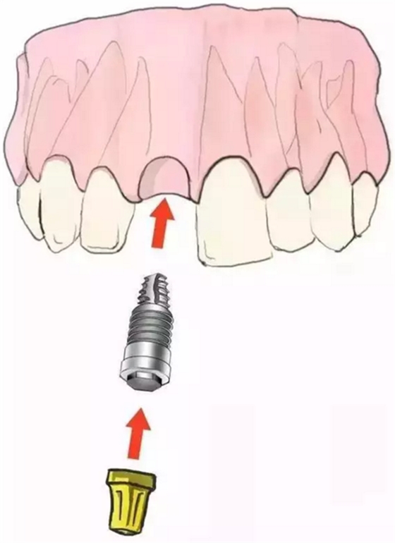 640 (600&times;809).png