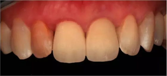 【培訓(xùn)】李京平 • 臨床精準(zhǔn)比色方案 • 8小時(shí)培訓(xùn)班.png 【培訓(xùn)】李京平 • 臨床精準(zhǔn)比色方案 • 8小時(shí)培訓(xùn)班.png