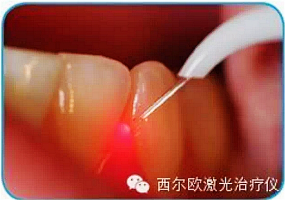 F980G@S3HN3_ZQ`11R[AIEW.png F980G@S3HN3_ZQ`11R[AIEW.png