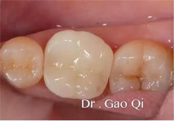 360截圖20170422163817936.jpg 360截圖20170422163817936.jpg