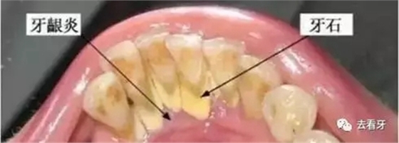 13.webp.jpg 13.webp.jpg