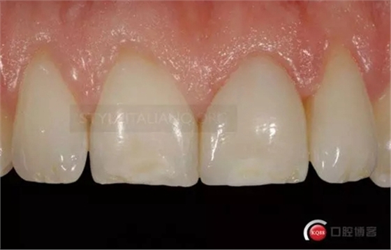 30.webp.jpg 30.webp.jpg