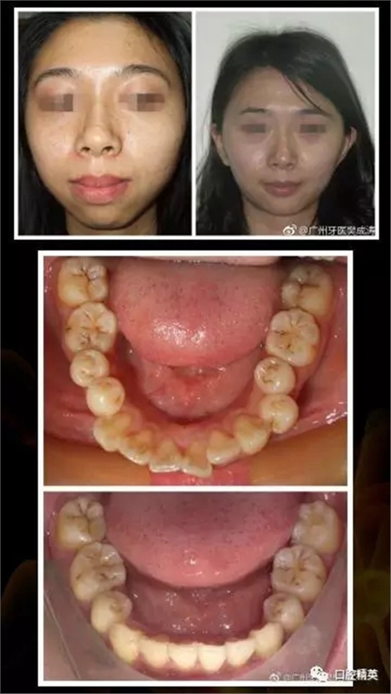 15.webp.jpg 15.webp.jpg