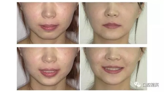 19.webp.jpg 19.webp.jpg