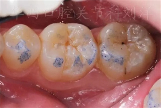 4.webp.jpg 4.webp.jpg