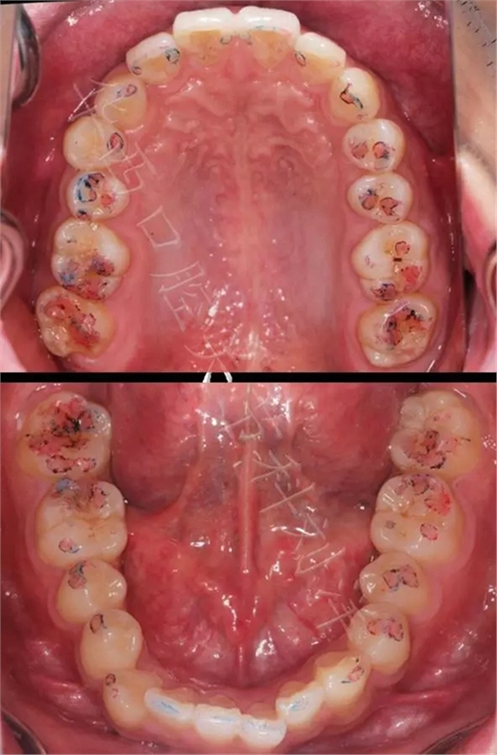 9.webp.jpg 9.webp.jpg