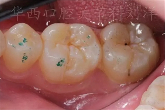 11.webp.jpg 11.webp.jpg