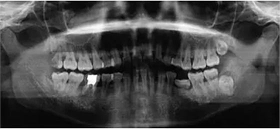 1.webp (1).jpg 1.webp (1).jpg