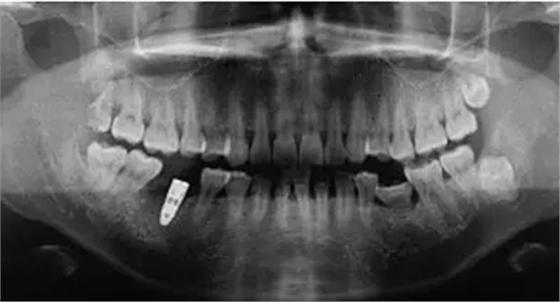 5.webp.jpg 5.webp.jpg