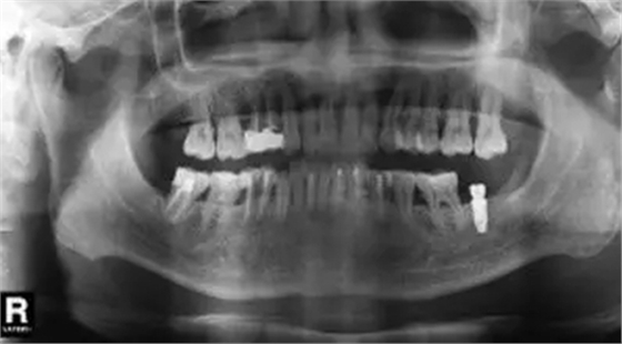 6.webp.jpg 6.webp.jpg