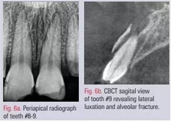 5.webp.jpg 5.webp.jpg