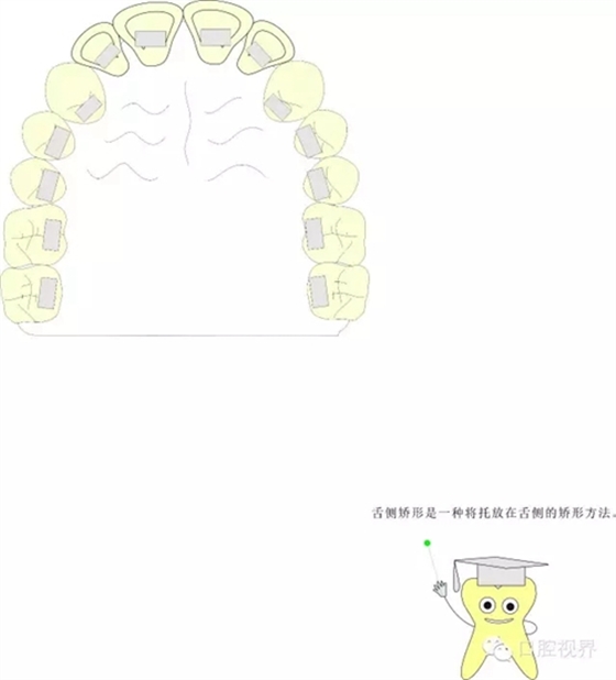 【愛牙科普知識(shí)300問】 &ldquo;什么是頜（牙）墊？&rdquo;