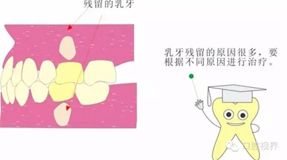 【愛牙科普知識300問】 &ldquo;什么是牙齦萎縮？&rdquo;