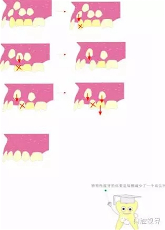  &ldquo;什么是牙周袋沖洗？&rdquo;