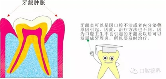 【愛(ài)牙科普知識(shí)300問(wèn)】 &ldquo;什么是牙本質(zhì)敏感？&rdquo;