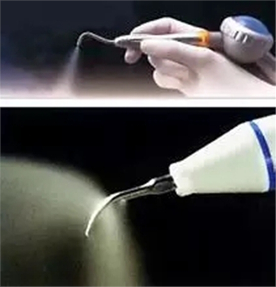 【愛牙科普】口腔謠言終結(jié)者&mdash;&mdash;每天刷牙，洗牙該不該？！