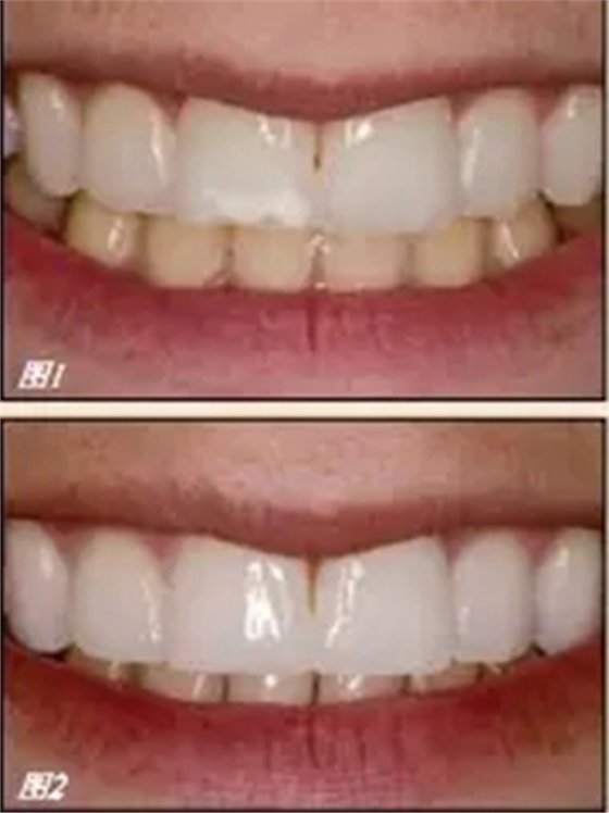 1.webp (1).jpg 1.webp (1).jpg