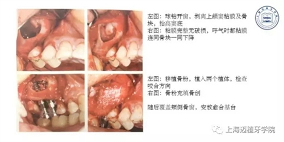 1.webp (1).jpg 1.webp (1).jpg