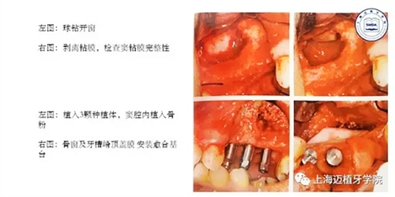 2.webp.jpg 2.webp.jpg