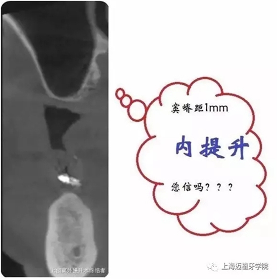 3.webp.jpg 3.webp.jpg