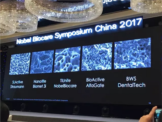 病例分享|復(fù)合樹(shù)脂微創(chuàng)美學(xué)修復(fù)關(guān)閉上前牙間隙 病例分享|復(fù)合樹(shù)脂微創(chuàng)美學(xué)修復(fù)關(guān)閉上前牙間隙