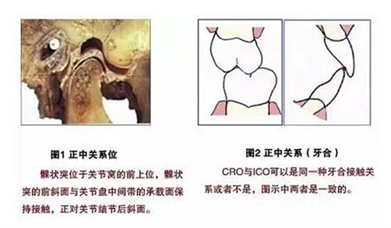 【臻美推薦】現(xiàn)代牙合學(xué)概念與全口固定義齒咬合重建 【臻美推薦】現(xiàn)代牙合學(xué)概念與全口固定義齒咬合重建