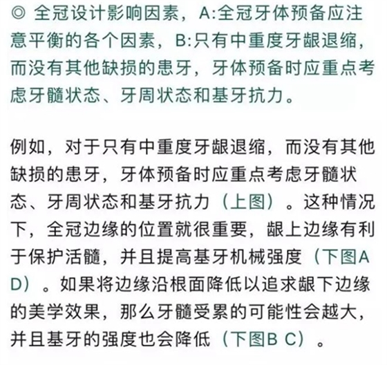 做全冠修復時基牙根面暴露，如何備牙？