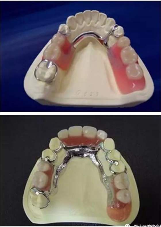 醫(yī)大口腔綜合科 |&ldquo;鑲牙&rdquo;的學(xué)問&mdash;&mdash;活動類 