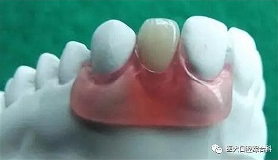 醫(yī)大口腔綜合科 |&ldquo;鑲牙&rdquo;的學(xué)問&mdash;&mdash;活動類 